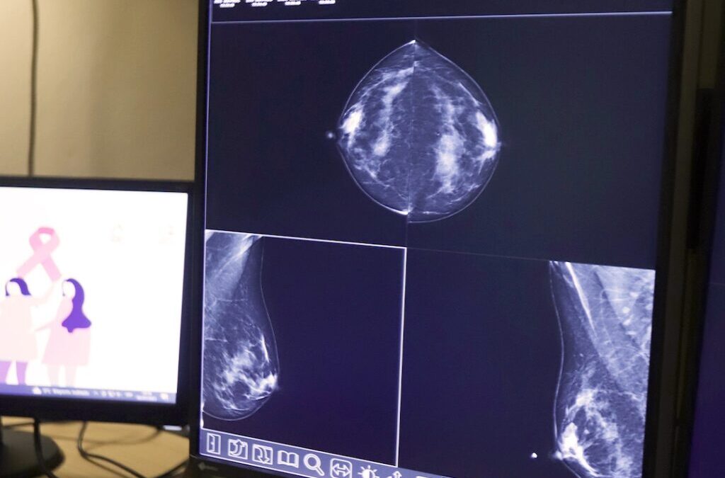 LUCCAU restablece las mamografías y llama a realizarse los controles